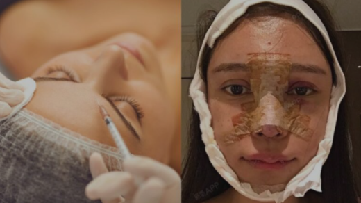 China Cosmetic Surgery Boom