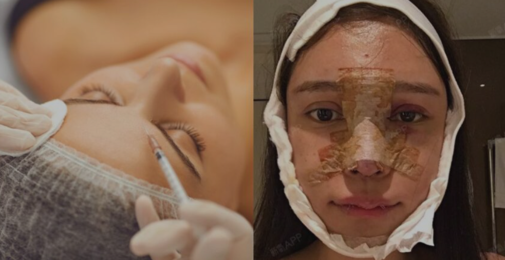 China Cosmetic Surgery Boom: The Price of Perfection China Cosmetic Surgery Boom
