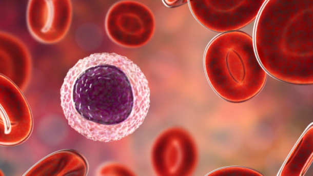 Hodgkin Lymphoma Symptoms