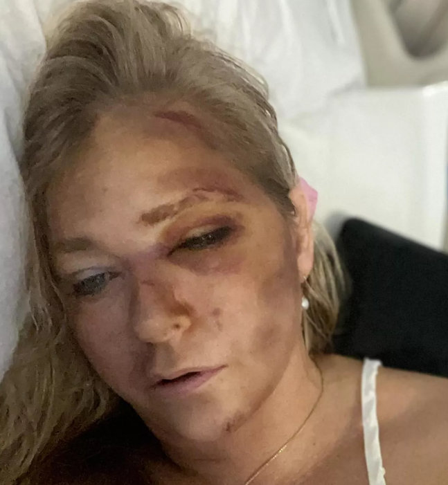 Virginia Giuffre Bus Accident Sparks Health Concerns Virginia Giuffre bus accident