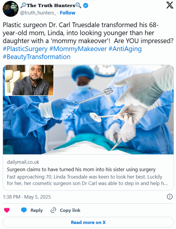 Deep Plane Facelift By Son Transforms 68-Year-Old Mom Deep Plane Facelift